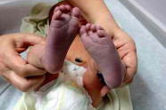 Comment Soigner Les Pieds Froids?