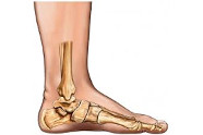 Comment Soigner Les Pieds Plats?