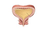 Comment Soigner Une Infection Urinaire?